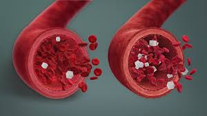 How Hypoglycemia Is Diagnosed