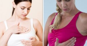 breast cancer symptoms