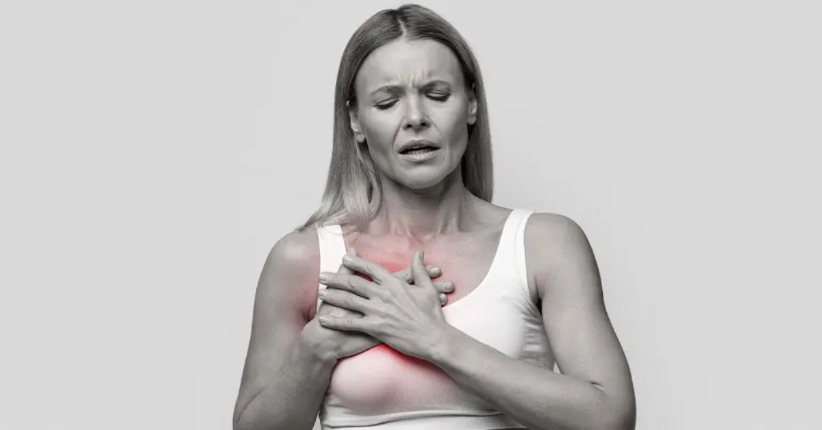 inflammatory breast cancer